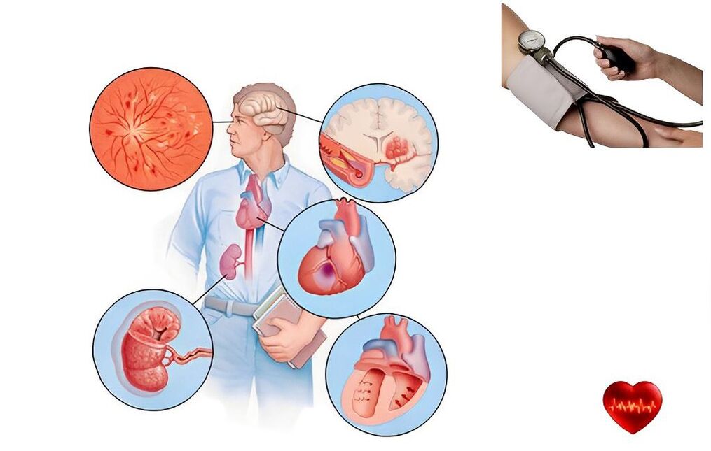 symptômes de l'hypertension